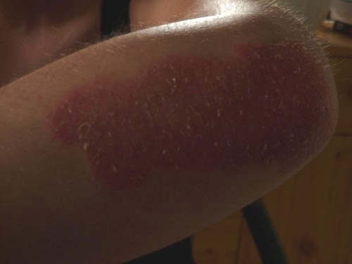 coudegauche22mai2013bis