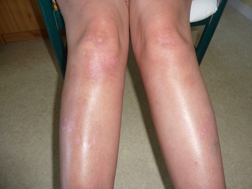 lesgenoux3septembre2013bis